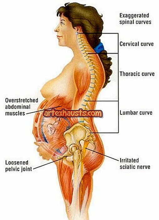 Боль в спине во время беременности. Cervical curve. Боль в спине после родов. Строение спины во время беременности.