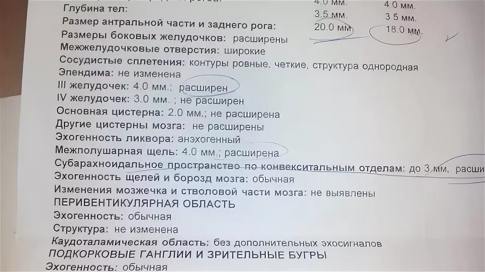 Расширение желудочков у новорожденного