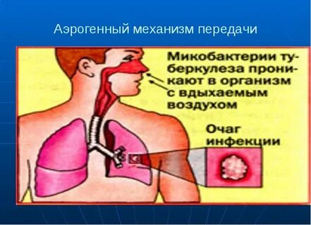 Аспирационный передача инфекции