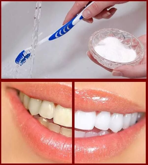 Средство отбеливания зубов Lanbena Teeth Whitening Essence LANBENA Эссенция. Зуб
