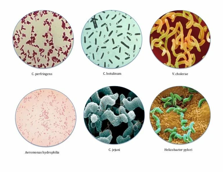 Clostridium botulinum микроскоп. Клостридии перфрингенс микроскопия. Клостридиум перфрингенс возбудитель. Клостридия перфрингенс микробиология.