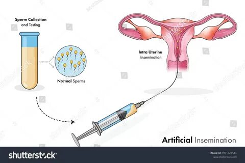 Aygestin ivf