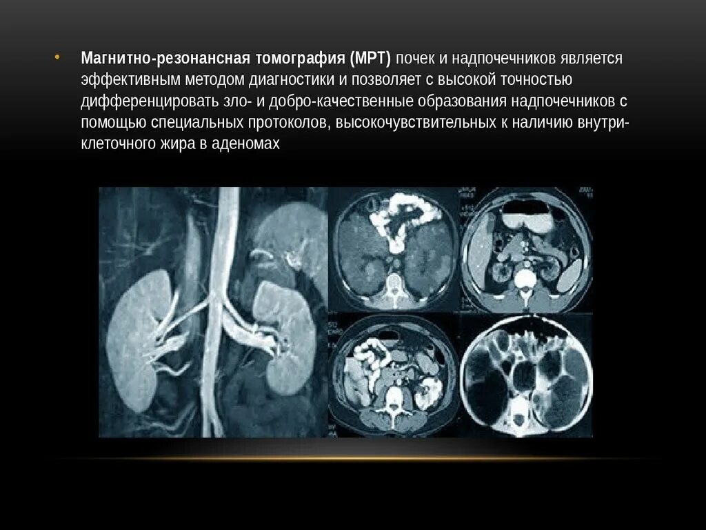 Мрт какие диагнозы. Контрастирование почек мрт. Снимок кт почек в норме. Компьютерная томография почек и надпочечников. Кт забрюшинного пространства (почки и надпочечники).