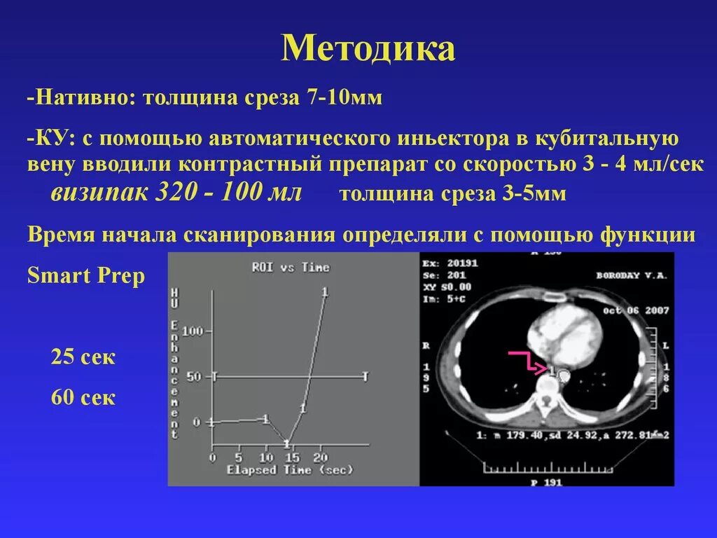 фантом измерение толщины среза. толщина среза на протяжке. остаточное сечение при точении. толщина и ширина срезаемого слоя. толщина среза.