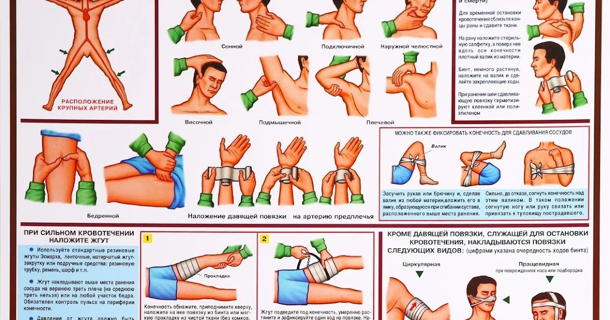Первая помощь при наружных кровотечениях тест. Остановка кровотечения. Кровотечение остановка кровотечения. Способы остановки кровотечения памятка. Схема остановки кровотечения.