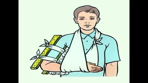 Медицинская помощь при переломах и вывихах