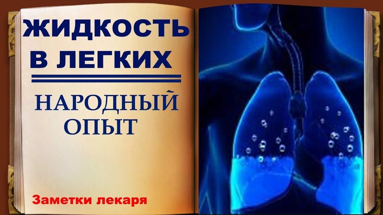 Тоны сердца при отеке легких. От чего собирается жидкость в легких. Причины плеврита легких. Причины образования жидкости в легких. Гидроторакс при пневмонии.