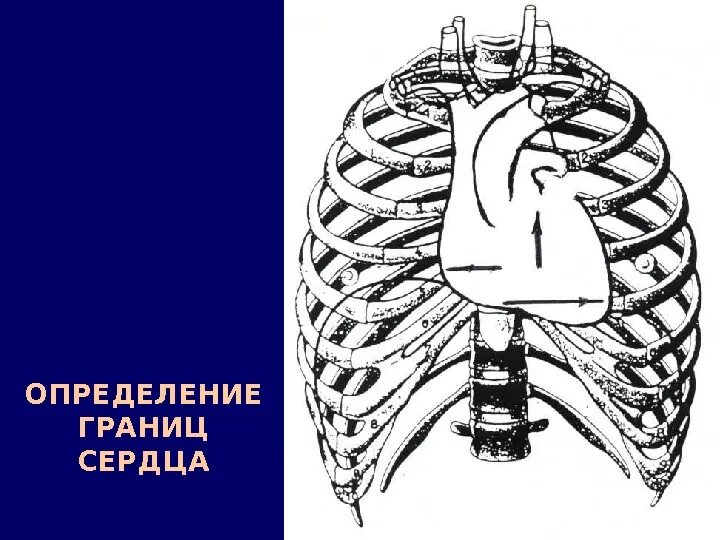 Верхняя граница сердца находится. Границы сердца расположение. Верхняя граница относительной тупости сердца в норме располагается. Перкуссия верхней границы сердца. Сердце границы сердца.