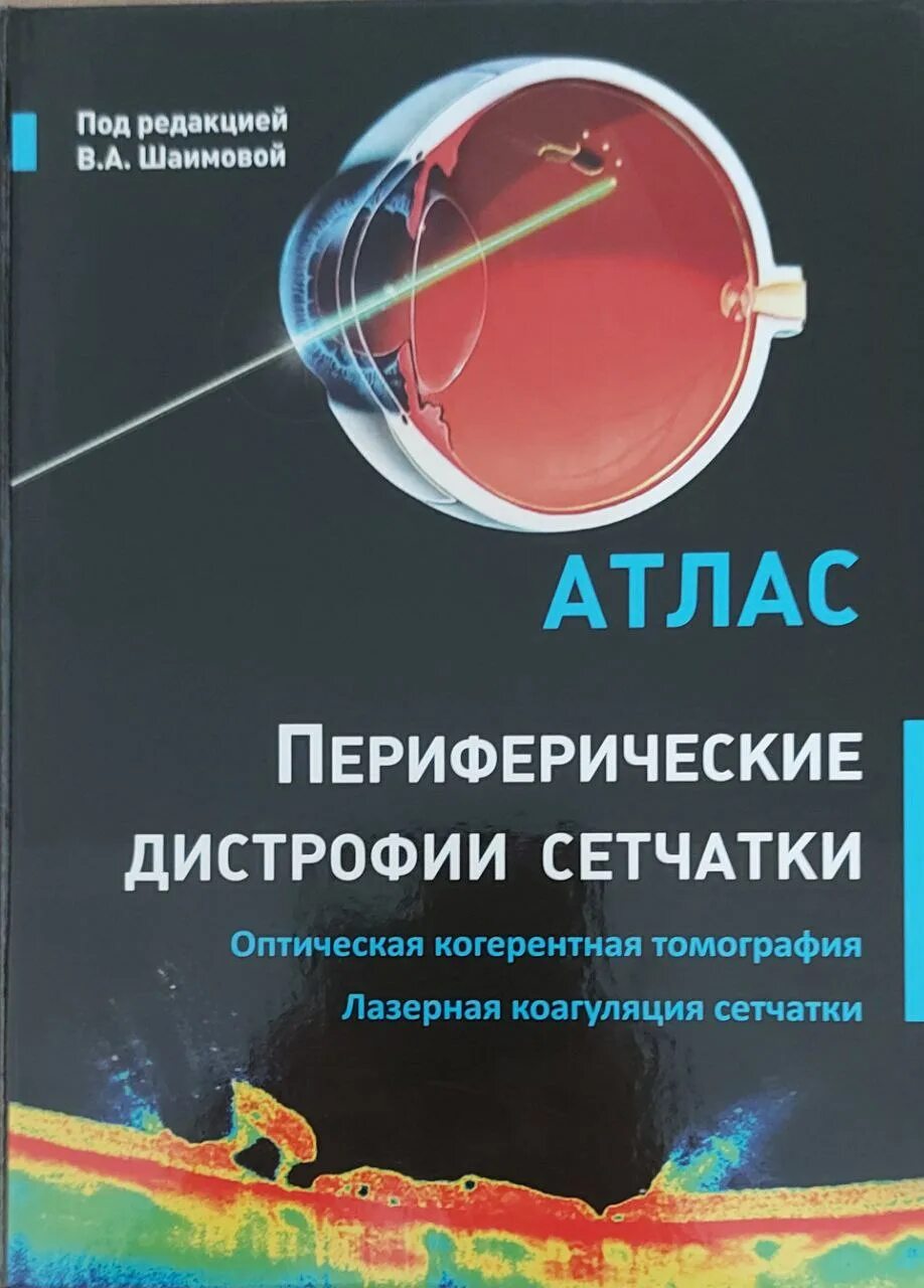 Атлас сетчатки. Периферические дистрофии сетчатки атлас. периферические дистрофии сетчатки шаимова в а. книги по окт. периферическая дегенерация сетчатки.