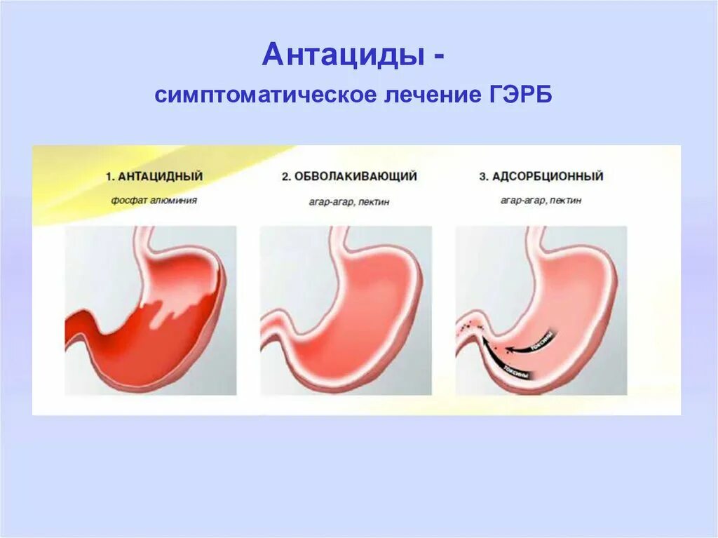 Итомед при рефлюксе. Итомед при гэрб. Блокирует дофаминовые д2 рецепторы. Ребагит при аутоиммунном заболевании назначают. Итомед при гэрб.