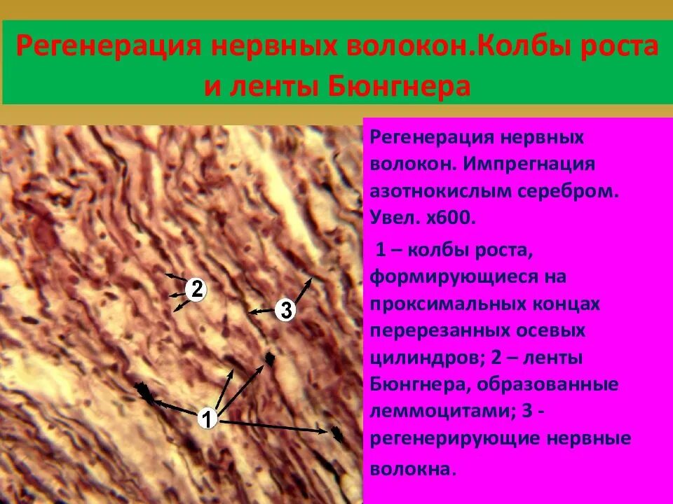 Нервные волокна гистология препарат. Нервная ткань гистология. Дегенерация нервных волокон гистология. Нервное волокно импрегнация серебром.