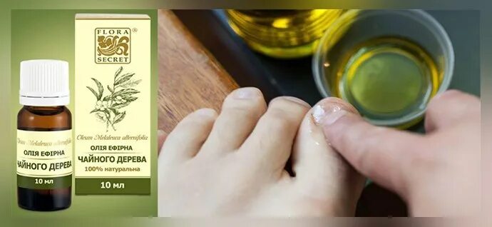 Как использовать чайное дерево для ногтей. Масло чайного дерева от грибка ногтей. Масло чайного дерева для ногтей от грибка ногтей. Масло чайного дерева и грибок ногтей. Масло чайного дерева от грибка ногтей на ногах.