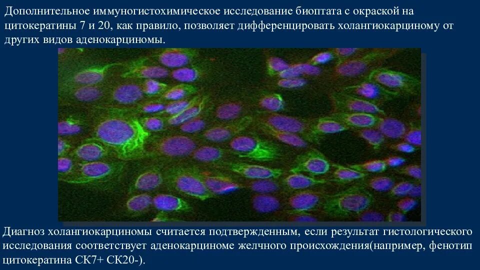 Иммуногистохимическое исследование (ИГХ исследование). Иммуногистохимические методы исследования. Иммуногистохимия метод гистология. Иммуногистохимический метод окрашивание.