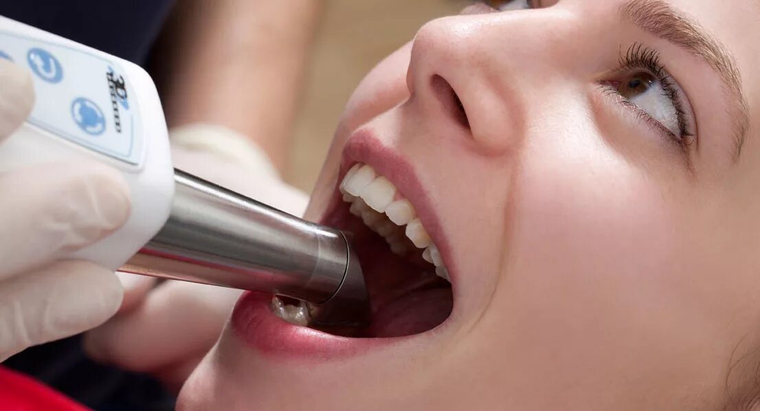 Криотерапия небных миндалин. Аденоиды у детей у детей. Криотерапия при аденоидах у детей. Криотерапия при аденоидах 3 степени. Узол терапия.