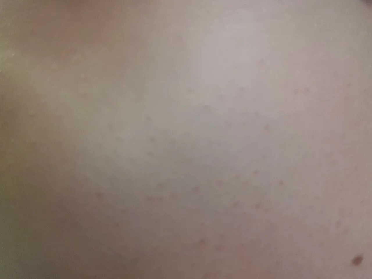 Мелкая сыпь на животе и спине фото Girls, please tell me, gave birth in Ufa, the child has a white rash on the chee