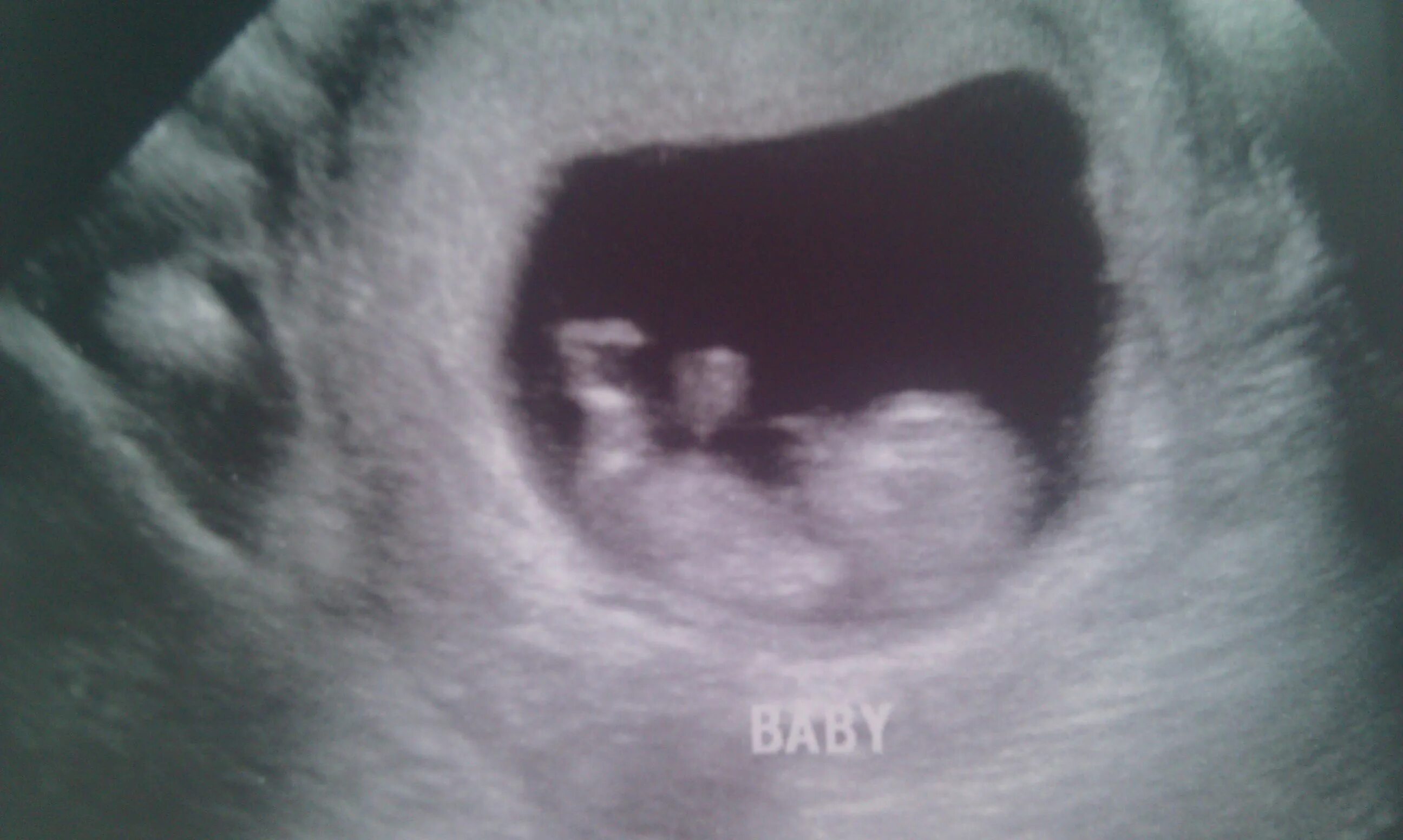 Беременность девять. 9-10 Недель беременности. Эмбрион на 10 неделе беременности.