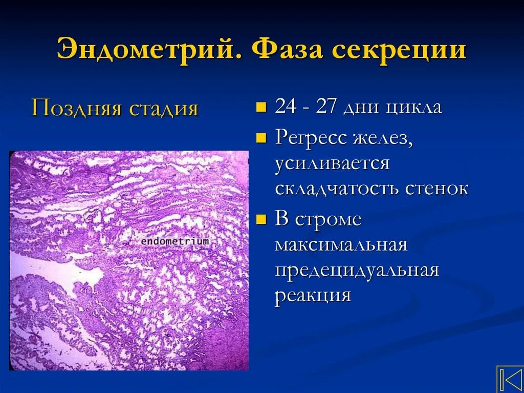 Эндометрий десквамация. Эндометриальный полип матки гистология. Фаза секреции эндометрия гистология. Эндометрий в фазе секреции. Секреторные железы эндометрия гистология.