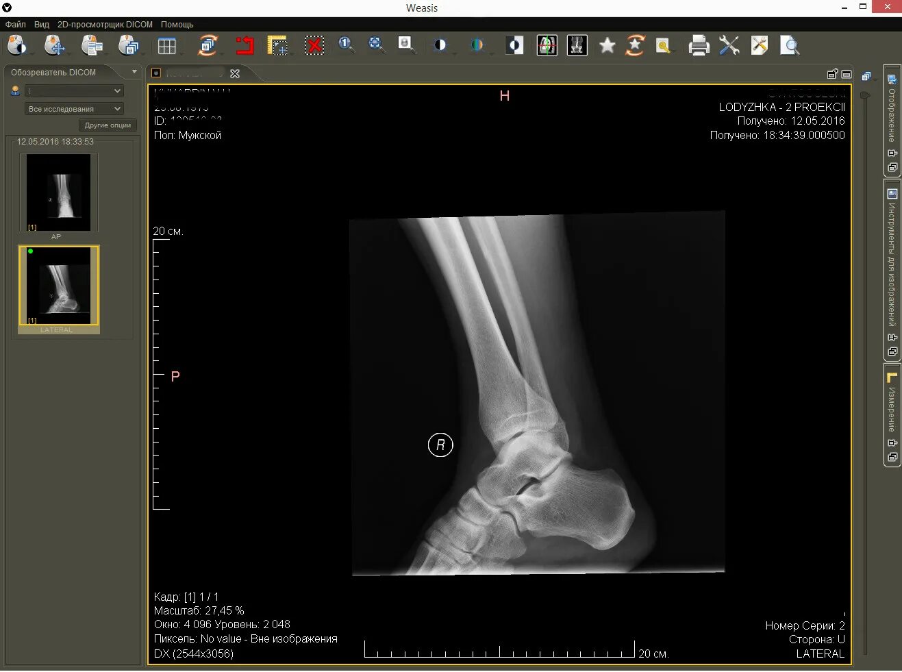 Dicom файлы мрт. Медицинский формат dicom. Dicom viewer windows. Просмотр dicom файлов. Dicom сервер.