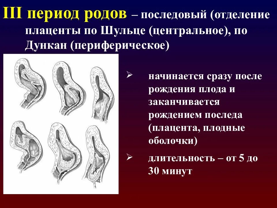 Период начинается и заканчивается. Отделение последа по Шульцу и Дункану. Периоды родов 3 период. Отделение плаценты по Шульцу. Третий период родов Последовый.