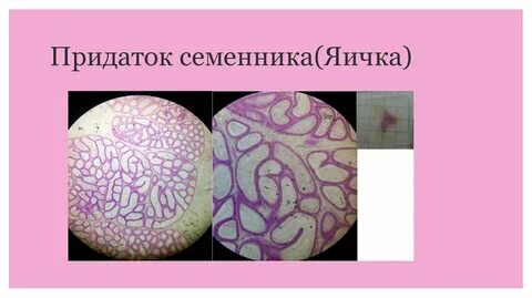 Придаток яичка гистология