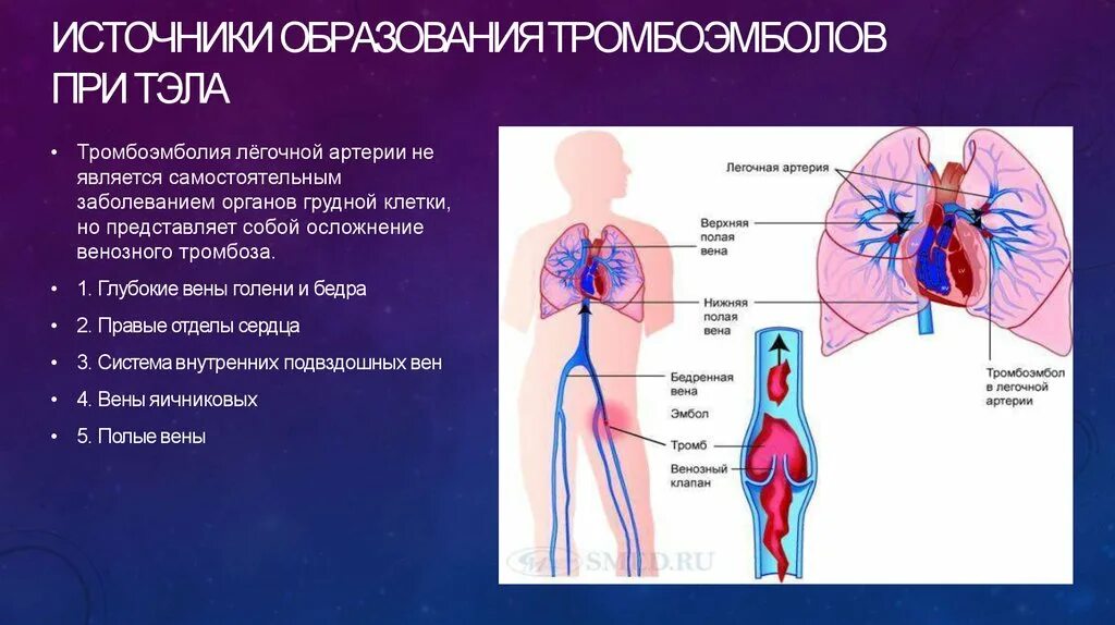 Тромбоэмболия легочной артерии клиника. Тромбоэмболия легочной артерии этиология. Источники тромбоэмболии легочной артерии. Тромбоэмболия легочной артерии клиническая картина. Оторвался тромб в легких