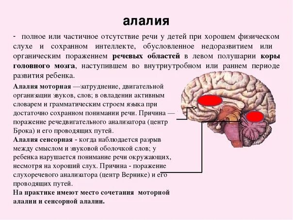 Недоразвитие зон мозга. Моторная алалия зоны поражения мозга. Локализация поражения при алалии. Локализация поражения мозга при алалии.. Локализация моторной и сенсорной алалии.