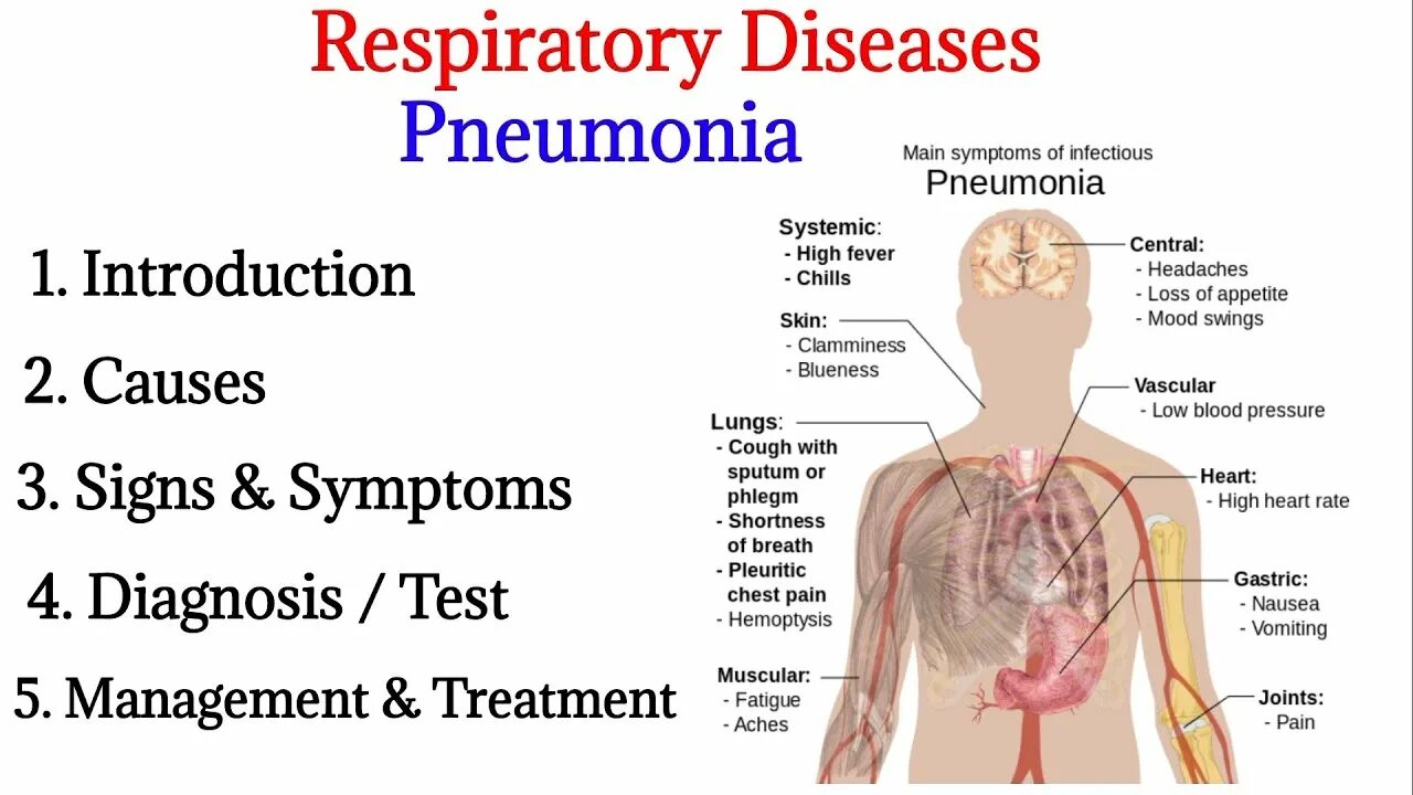Профилактика пневмонии. Pneumonia respiratory rate. Инфлюэнция. Профилактика пневмонии. Hyaline membrane respiratory.