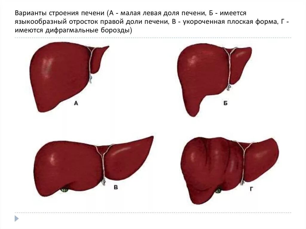 Печень какой формы. Саблевидная форма левой доли печени.