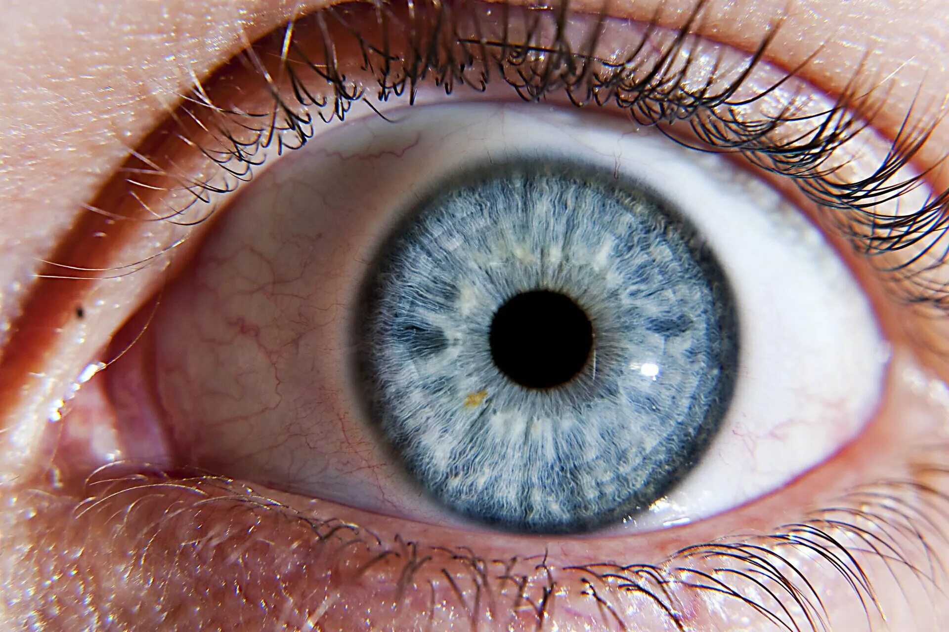 Eye go