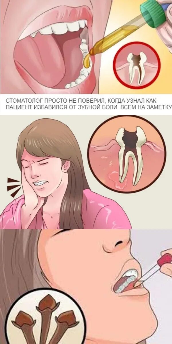 Зубная боль. Методы избавления от зубной боли.