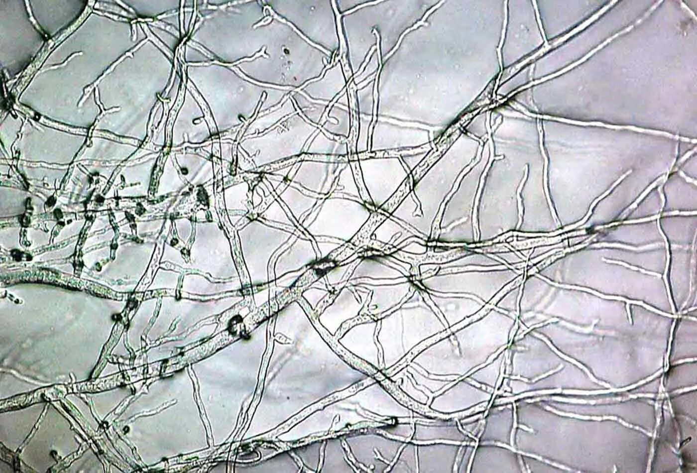 Мицелий гриба гиф. Мицелий под микроскопом. Плесневые грибы микроскопия. Нити мицелия микроскопия. Нити гриба под микроскопом.