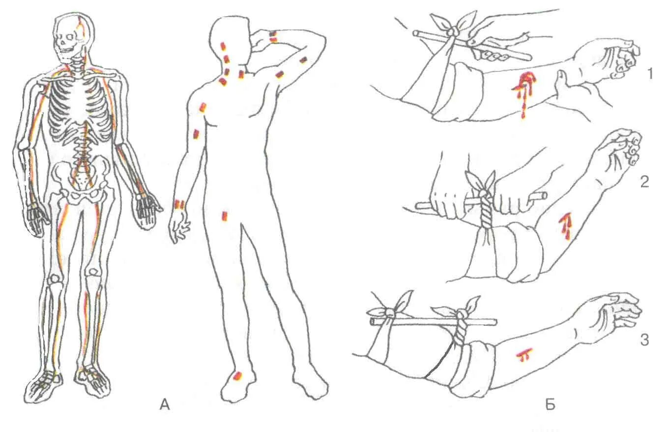 Точки прижатия артерий при кровотечении. Точки прижатия артерий при кровотечении схема. Точки прижатия артерий на теле человека. Точки пальцевого прижатия артерий при артериальном кровотечении.