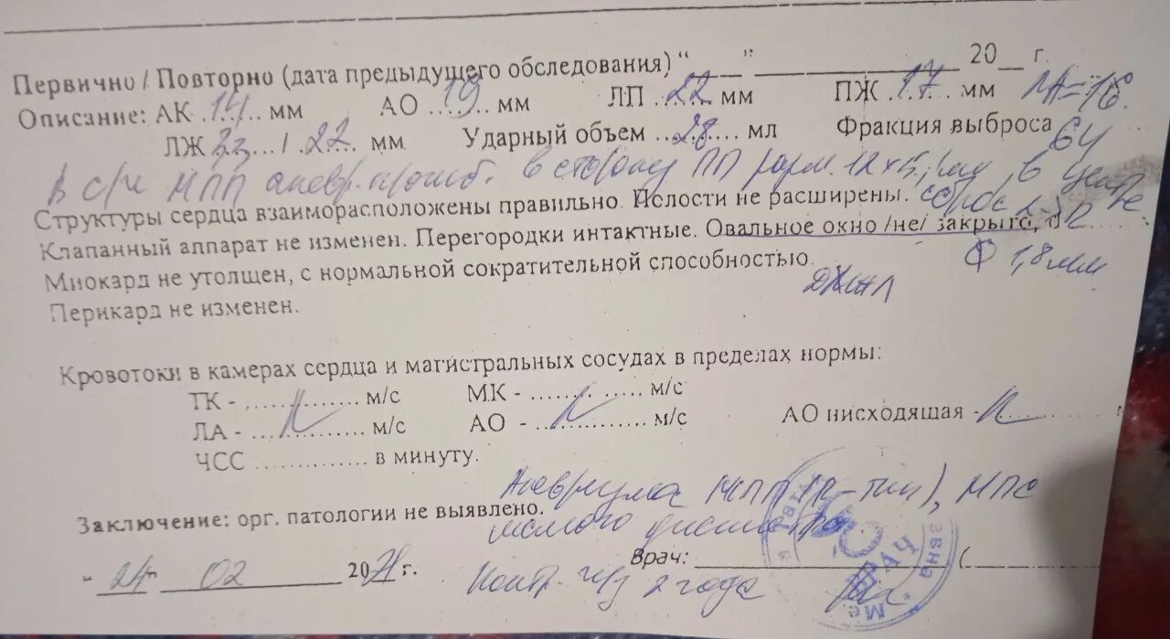 Аневризма мпп без. Аневризма мпп на узи. аневризма мпп у подростка.