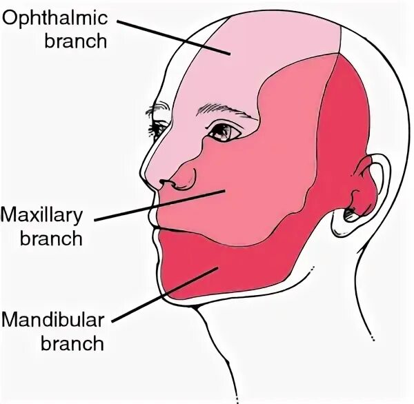 Neuralgia латынь. Trigeminal nerve. nervus trigeminus anatomy. trigeminal neuralgia open surgery.