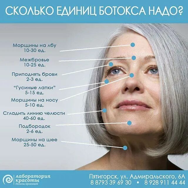 Сколько надо ботокса. Схема введения ботокса в лоб. зоны введения ботокса на лице. схема введения ботокса в межбровье. схема введения ботокса на лице.