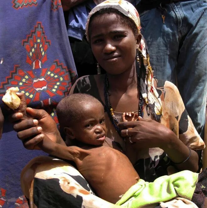 Голодающая девушка в Африке. Голодающие дети Сомали. Жизненный голод