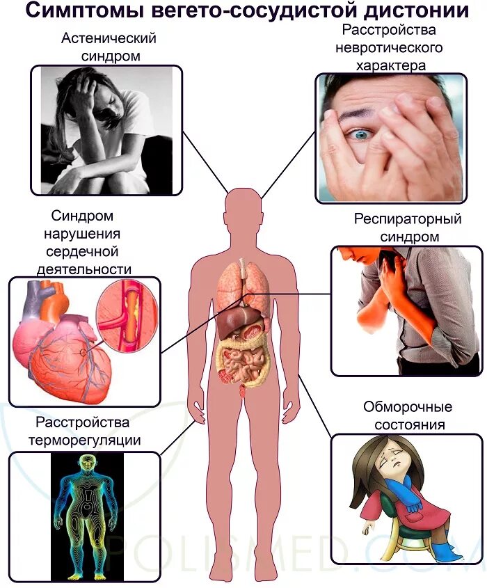 Симптомы всд у мужчин. Вегетососудистая дистония симптомы. Вегетативно сосудистая дистония симптомы. Вегасосудочная дистония симптомы. Сосудистодисания симптомы.