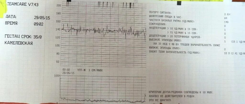 Заключение КТГ В норме. Вариабельность КТГ норма. Вариабельность коротких интервалов КТГ норма. КТГ при беременности. Шевеления на 35 неделе