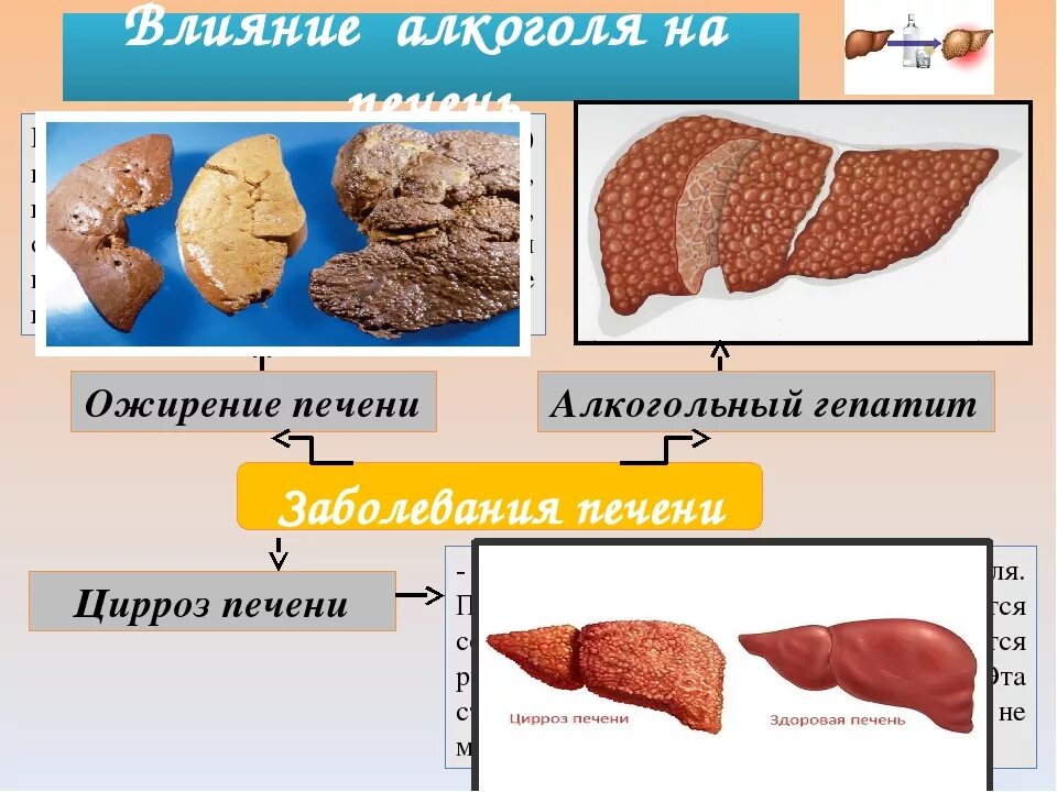 Печень человека алкоголика. Воздействие этанола на печень.