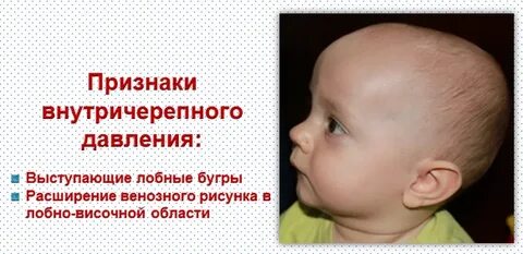 Черепной новорожденных