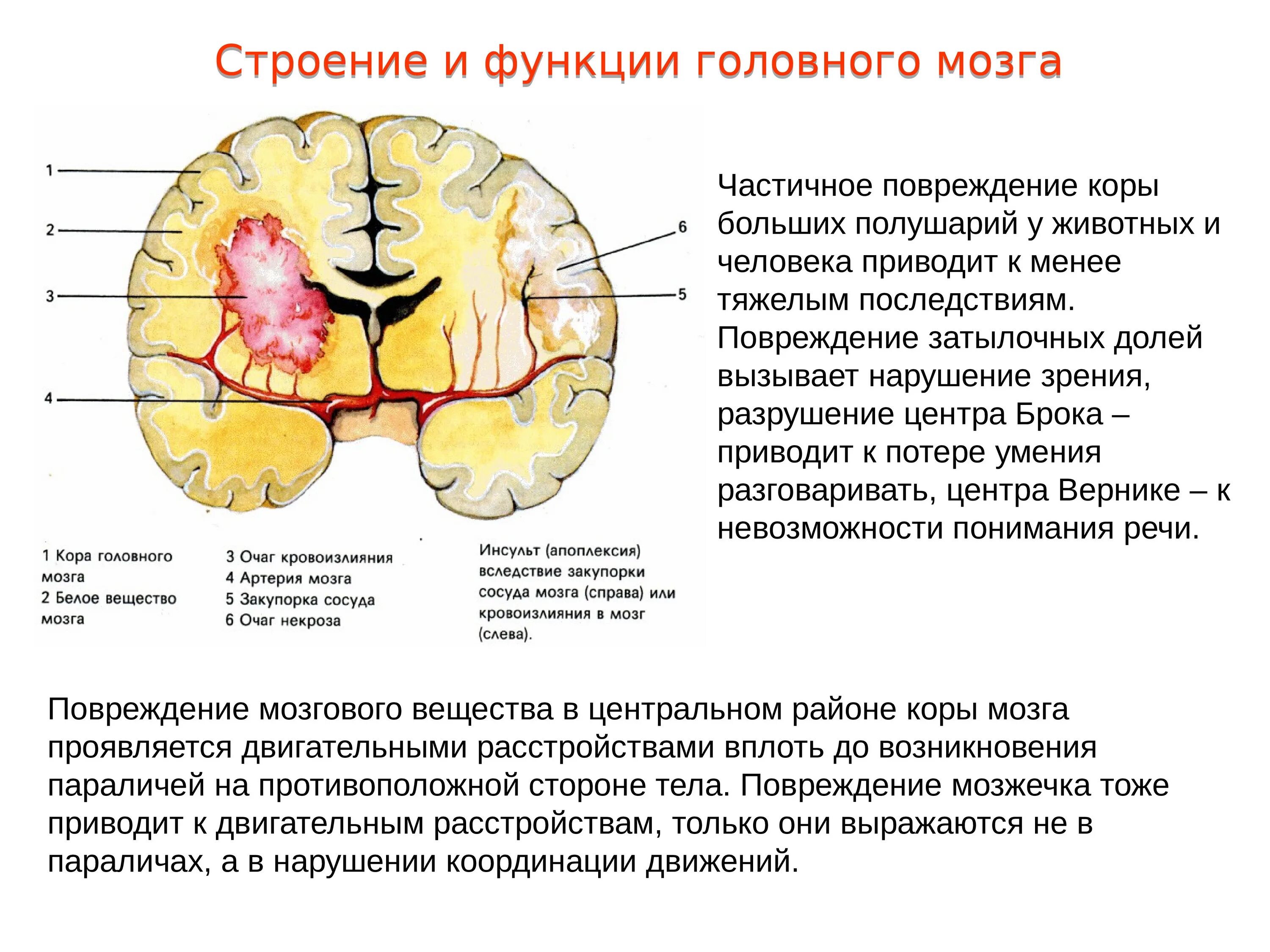 Повреждение коры мозга