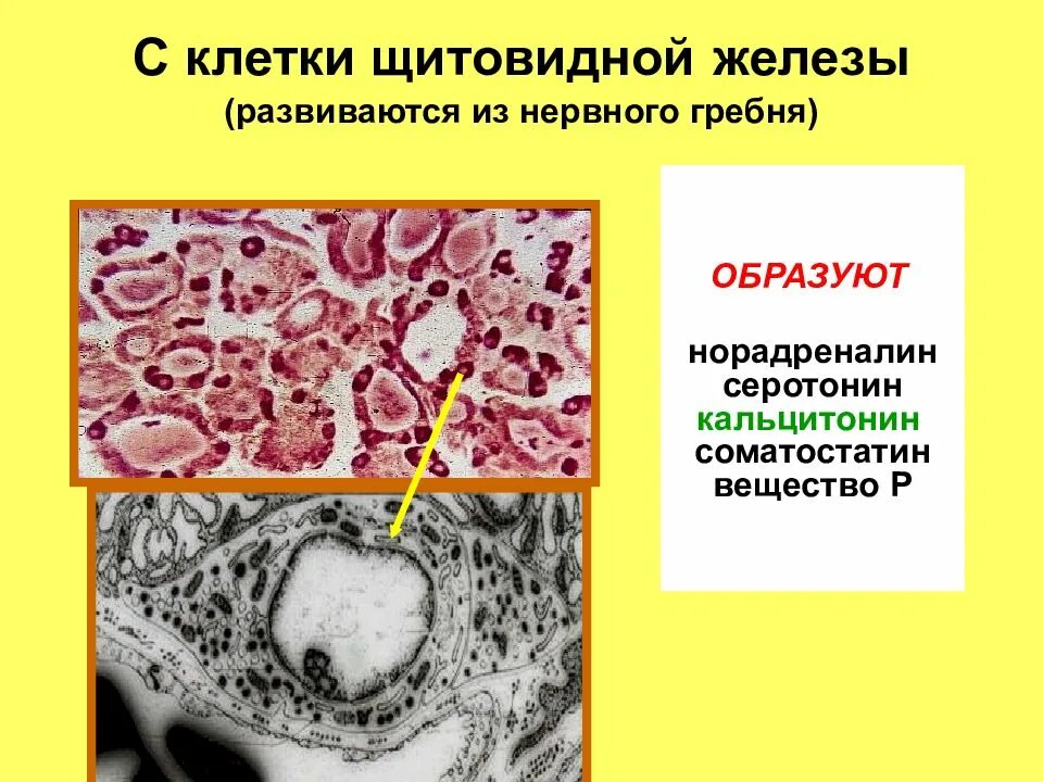 Гистология эндокринных желез. Гормоны щитовидной железы гистология. эндокринная клетка гистология. клетки щитовидной железы гистология. клетки щитовидной железы гистология клетки.