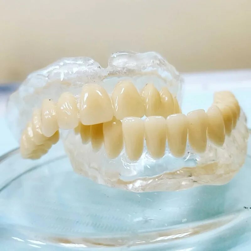 Зубные протезы нового поколения цена. Съемный протез из пластмассы. Силиконовый съемный протез. Силиконовые зубные протезы.
