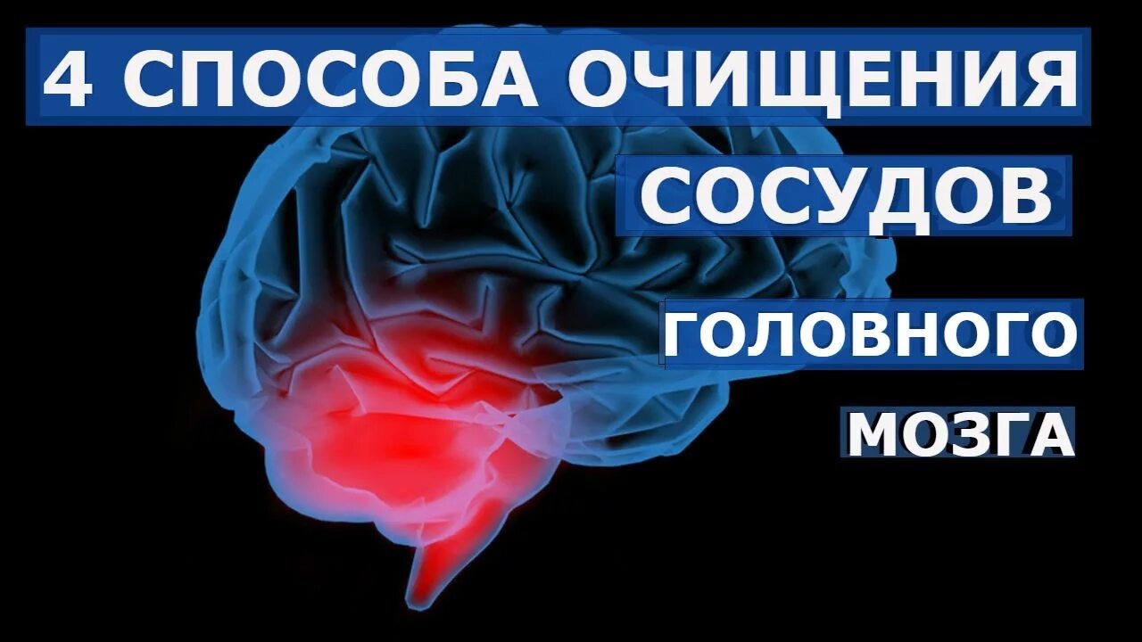 Сосуды головного мозга отзывы. Очищение сосудов головного. средства для чистки сосудов головного мозга. препараты чистящие сосуды головного мозга.