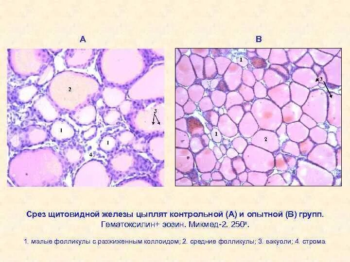 Срез щитовидной железы. Срез щитовидной железы гистология. Фолликулы щитовидной железы (гематоксилин-эозин). Щитовидная железа гематоксилин эозин. Щитовидная железа окраска гематоксилином и эозином.