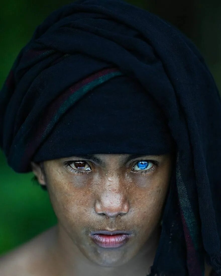 Необычайные глаза. Электрические глаза племени бутунг. Синдром Ваарденбурга племя. Племя бутунг с голубыми глазами.