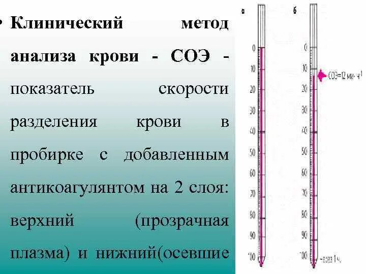 Соэ мм ч что значит. Метод Панченкова СОЭ методика. .Методика постановки СОЭ методом Панченкова.. СОЭ В крови метод Панченкова. Методика определения СОЭ по Панченкову.