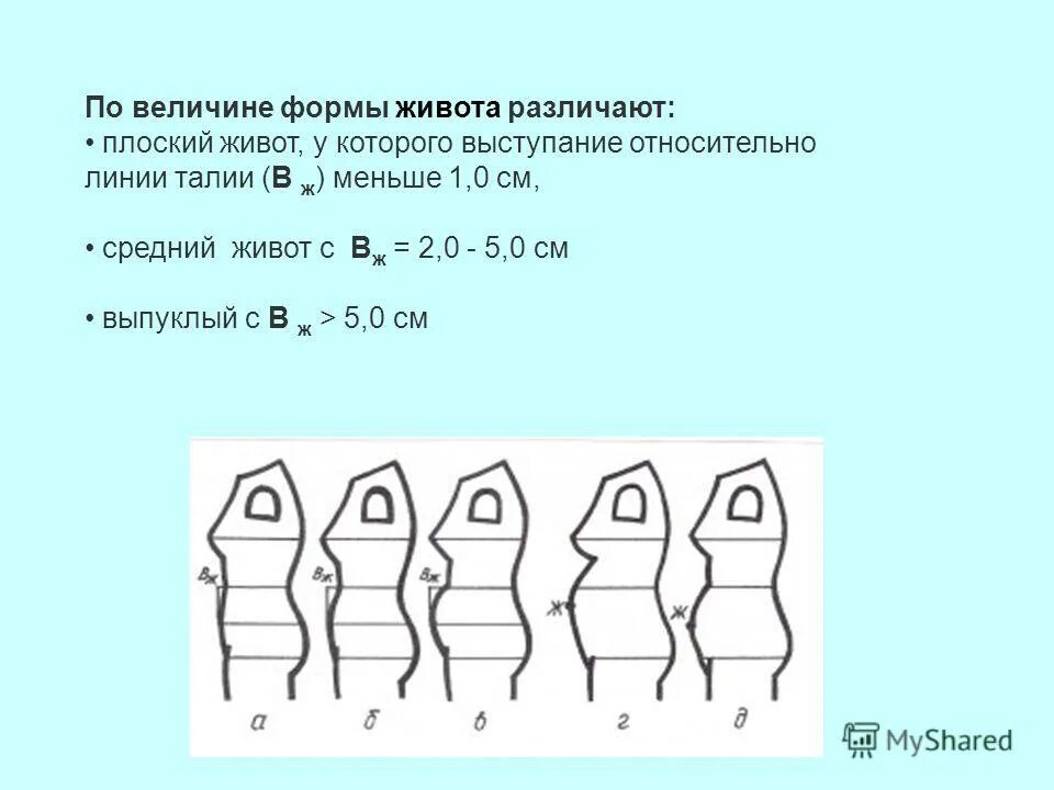 Разные формы живота у женщин. Оценка формы живота. Форма живота. Формы живота у мужчин. Стрессовый и гормональный живот.