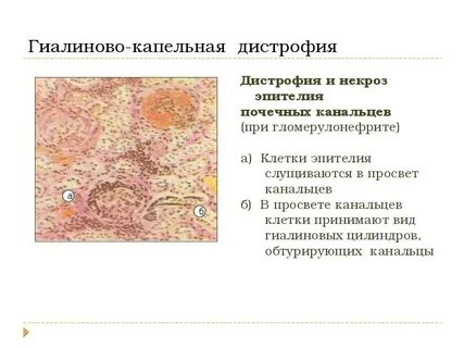 Почечная атрофия