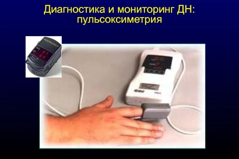 Пульсоксиметрия алгоритм выполнения. Пульсоксиметрия мониторинговая. пульсоксиметрия при дыхательной недостаточности. компьютерная мониторинговая пульсоксиметрия. пульсоксиметрия в анестезиологии.